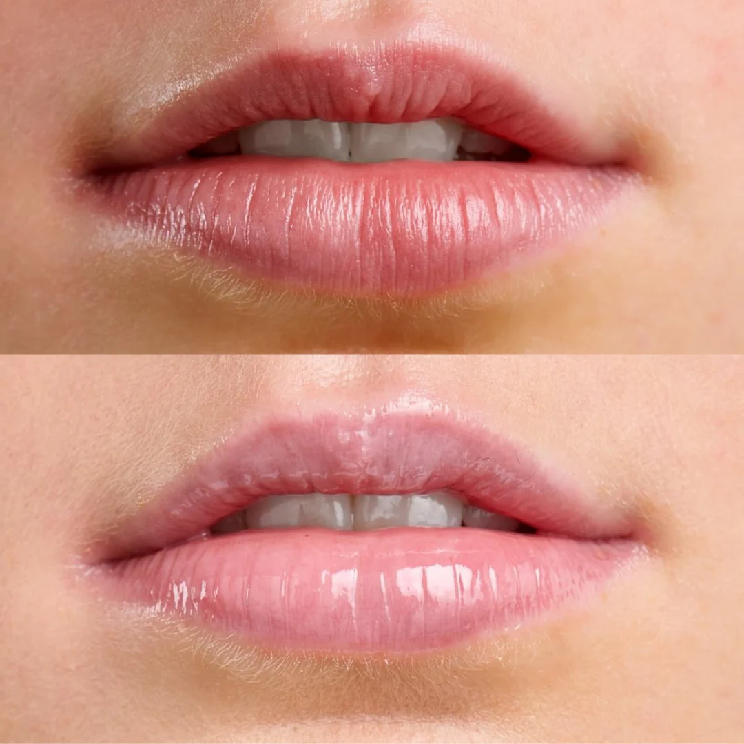 Lip Spa Lip Serum - Image 9