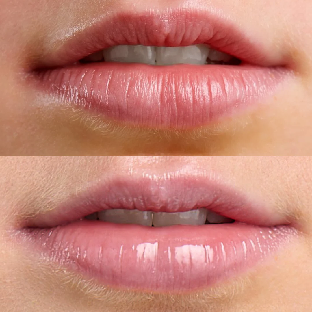 Lip Spa Overnight Lip Mask - Image 5